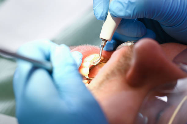 Best Emergency Denture Repair in Griffin, GA