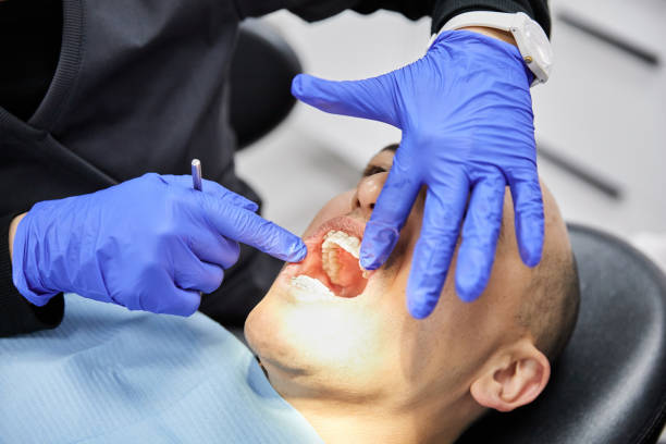 Best Emergency Root Canal Therapy in Griffin, GA